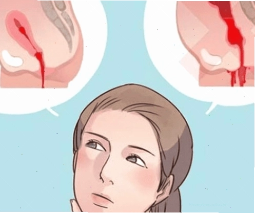 Sản dịch sau sinh đỏ tươi thường ra nhiều nhất trong vài ngày đầu
