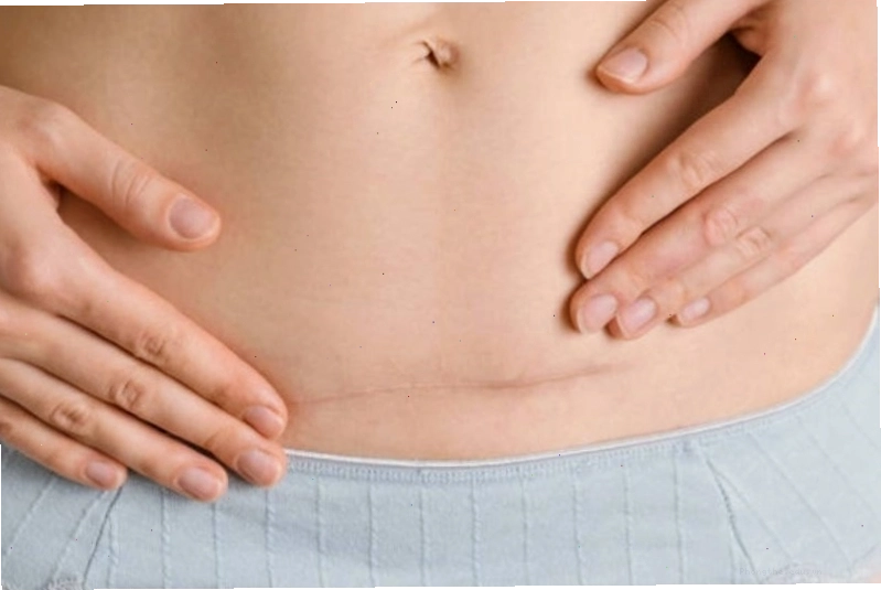 Sau sinh mổ mẹ cần thời gian dài để phục hồi sức khỏe