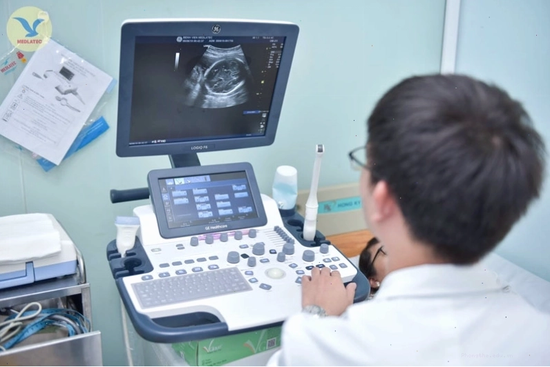 Siêu âm thai giúp phát hiện sớm các bất thường ở túi thai và nghe tim thai
