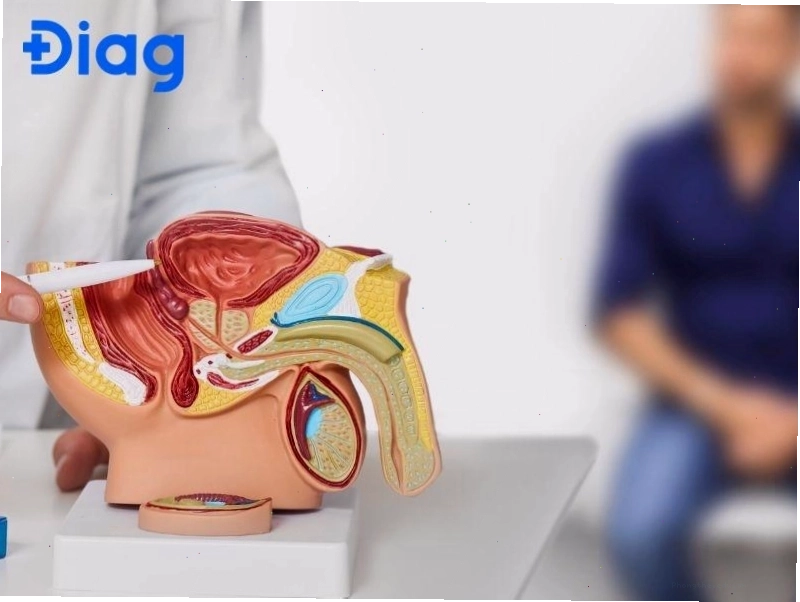 Siêu âm tiền liệt tuyến là công cụ định hướng chữa trị lâu dài cho nam giới