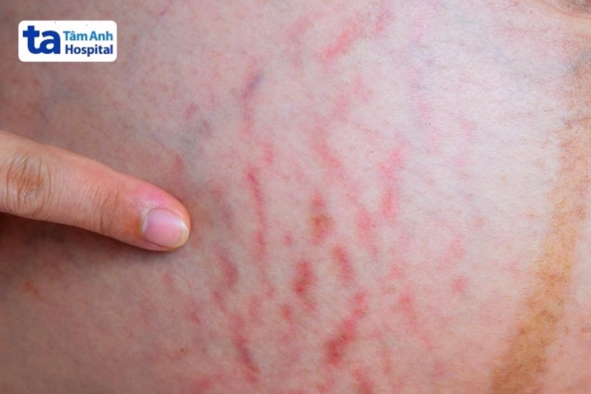 Sự phát triển kích thước của bầu ngực trong thai kỳ
