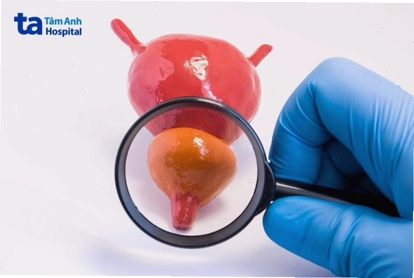 Tầm soát tuyến tiền liệt định kỳ giúp phát hiện sớm bệnh