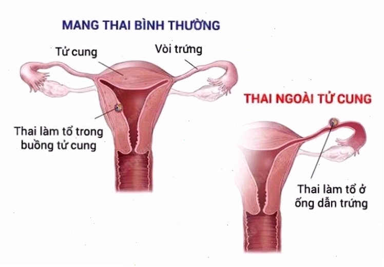 Thai nhi đang phát triển trong bụng mẹ