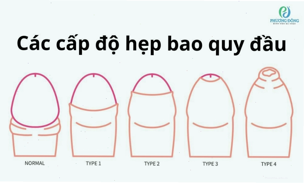 Thăm khám sức khỏe nam khoa