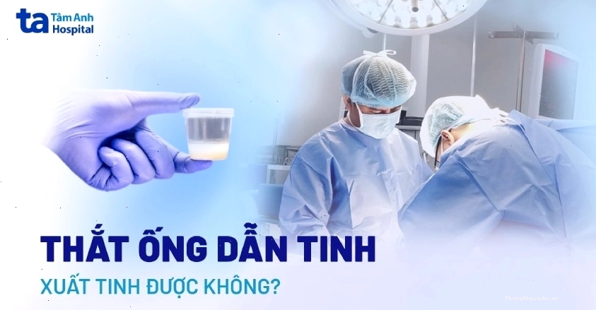 Thắt ống dẫn tinh vẫn có thể xuất tinh bình thường