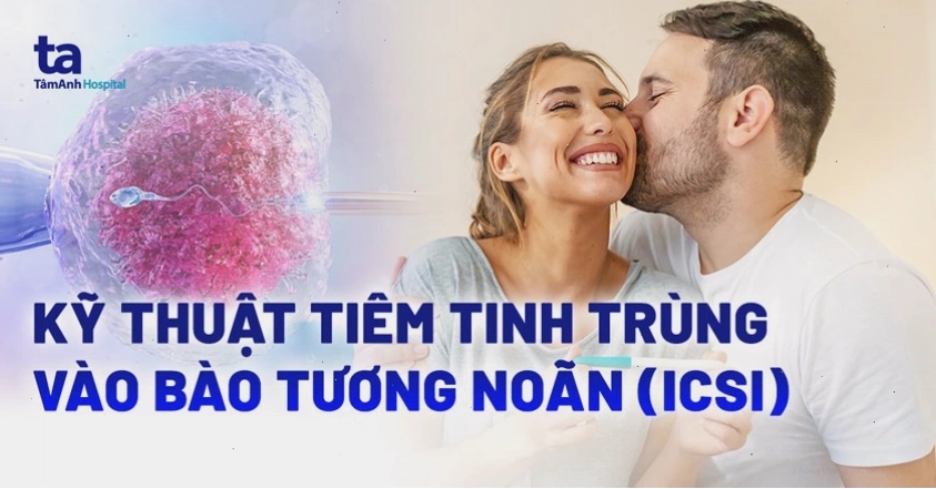 tiêm tinh trùng vào bào tương noãn