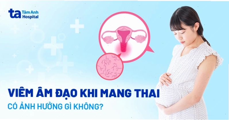 Viêm âm đạo khi mang thai là vấn đề sức khỏe cần được quan tâm