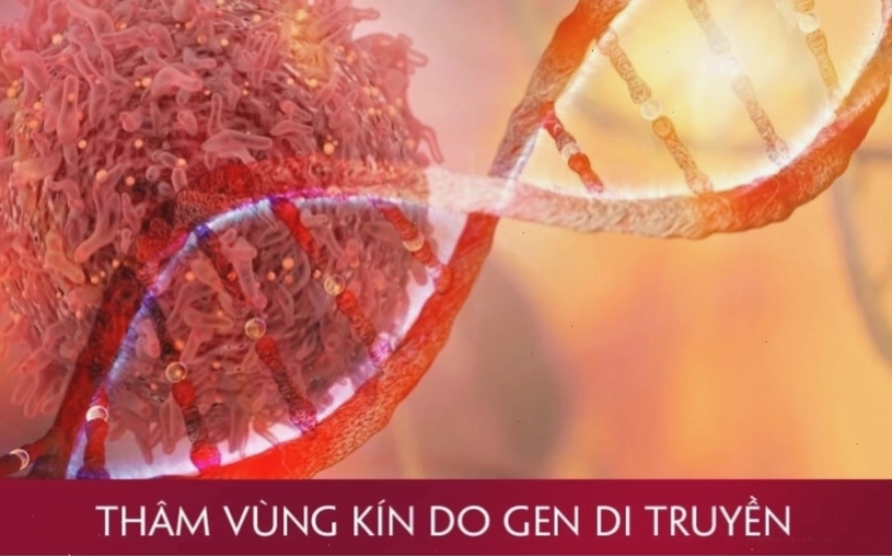 Vùng kín bị thâm do yếu tố di truyền và thay đổi nội tiết tố