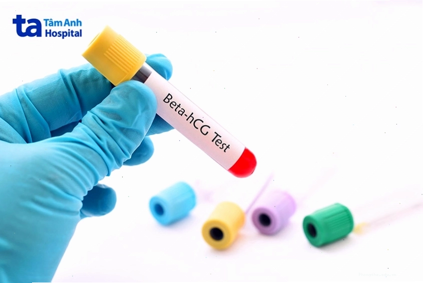 Xét nghiệm beta-hCG để xác định mang thai