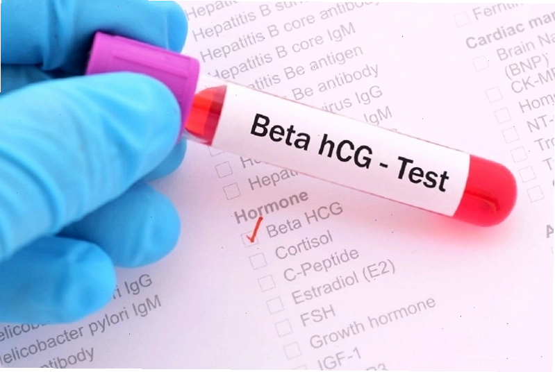 Xét nghiệm máu đo nồng độ hormone hCG để chẩn đoán thai sớm