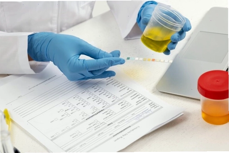 Xét nghiệm nước tiểu là phương pháp quan trọng để tìm nguyên nhân tiểu buốt