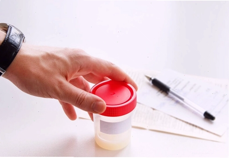 Xét nghiệm tinh dịch đồ thường được chỉ định cho nam giới để kiểm tra sức khỏe sinh sản phái mạnh