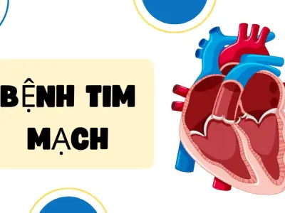 Bệnh tim mạch- Dấu hiệu cảnh báo và cách phòng ngừa sớm
