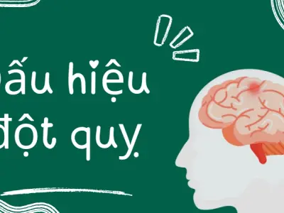 Dấu hiệu đột quỵ dễ nhận ra nhưng 99% người việt bỏ qua