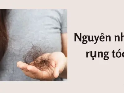 Nguyên nhân rụng tóc và thói quen hại da đầu mỗi ngày