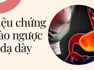 Triệu chứng trào ngược dạ dày âm thầm phá sức khỏe