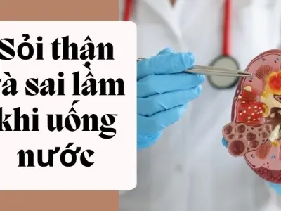 Sỏi thận và sai lầm khi uống nước rất nhiều người mắc phải
