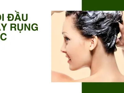 Tôi đã thoát cảnh rụng tóc nhiều nhờ thay đổi thói quen