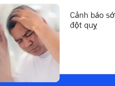 Nhận biết triệu chứng đột quỵ sớm- Kinh nghiệm cứu mạng