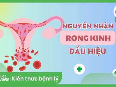 Bệnh Rong Kinh: Nguyên nhân, Dấu hiệu và Cách Điều trị Hiệu quả
