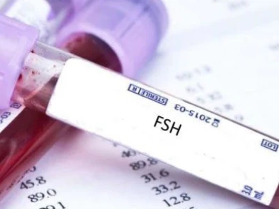 Định lượng FSH là gì? Chỉ số bình thường và ý nghĩa