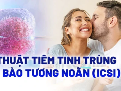 ICSI là gì? Hướng dẫn chi tiết quy trình và những điều cần biết