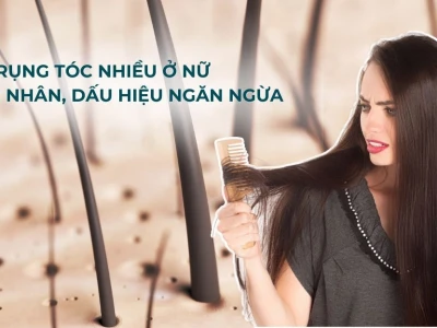 Nguyên nhân rụng tóc nhiều ở nữ giới và cách khắc phục hiệu quả