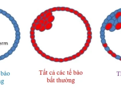 Phôi khảm là gì và những điều cần biết về phôi khảm trong IVF