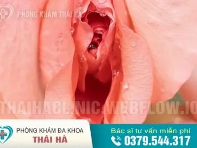 Quan hệ nhiều có bị rộng không? Nguyên nhân và cách khắc phục