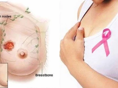 Quầng vú là gì? Cấu tạo, chức năng và các vấn đề sức khỏe liên quan