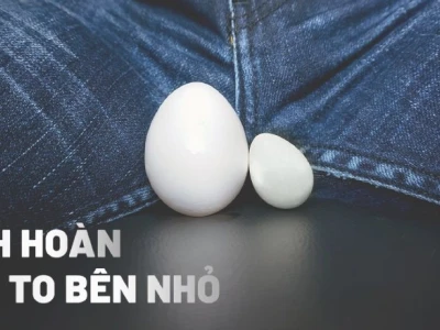 Tinh hoàn bên to bên nhỏ có ảnh hưởng gì không? Nguyên nhân và cách xử lý
