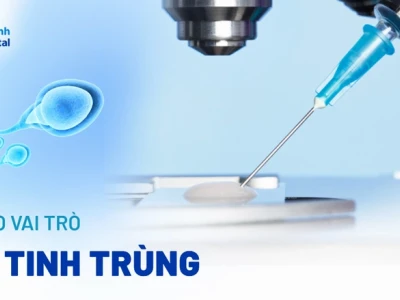 Tinh trùng là gì? Giải đáp chi tiết về cấu tạo, vai trò và quá trình hình thành