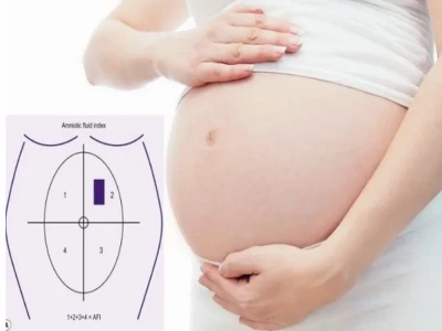 Xoang ối lớn nhất là gì? Giải đáp chi tiết và các chỉ số cần biết